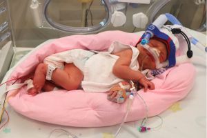 Baby Khaleesi pictured at 1 day old in the FSH Neonatal Unit attached to a ventilator. 
